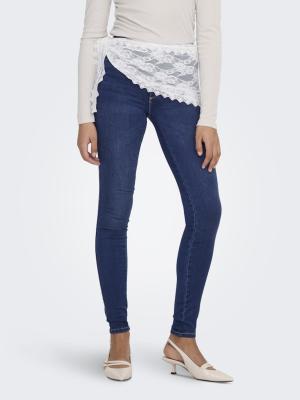 Damen Skinny - Jeans | ONLROYAL LIFE HW SKINNY BB BJ13964